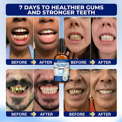 🦷 US Official Store | PuraCure® Tooth & Gum Oral Repair Solution | Powered by Bee Venom Peptides × Collagen × Postbiotics × Beta-Glucanase to Fight Plaque, Tartar, Tooth Pain, Bad Breath & Weak Teeth