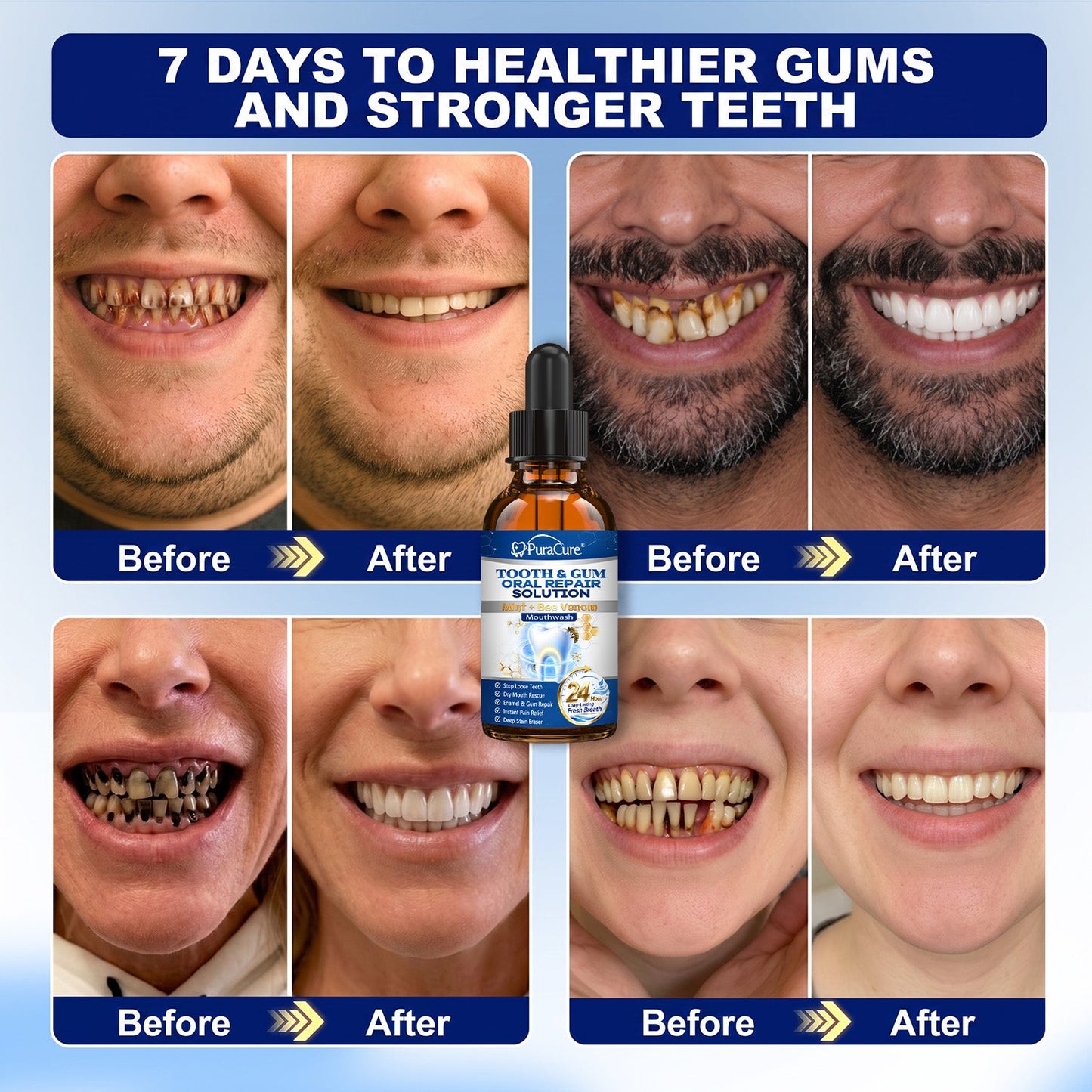 🦷 US Official Store | PuraCure® Tooth & Gum Oral Repair Solution | Powered by Bee Venom Peptides × Collagen × Postbiotics × Beta-Glucanase to Fight Plaque, Tartar, Tooth Pain, Bad Breath & Weak Teeth