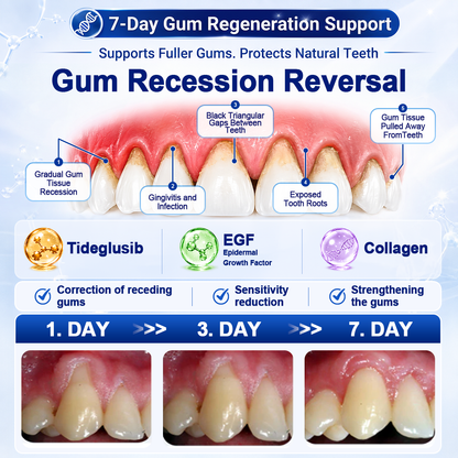 🦷 US Official Store | PuraCure® Tooth & Gum Oral Repair Solution | Powered by Bee Venom Peptides × Collagen × Postbiotics × Beta-Glucanase to Fight Plaque, Tartar, Tooth Pain, Bad Breath & Weak Teeth