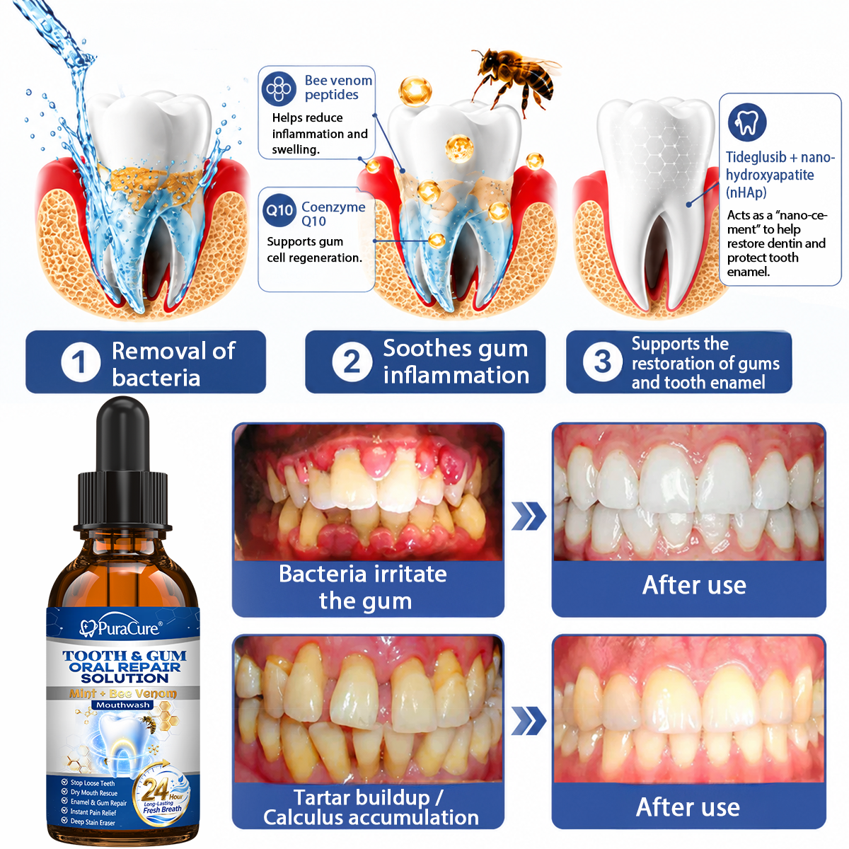 🦷 US Official Store | PuraCure® Tooth & Gum Oral Repair Solution | Powered by Bee Venom Peptides × Collagen × Postbiotics × Beta-Glucanase to Fight Plaque, Tartar, Tooth Pain, Bad Breath & Weak Teeth